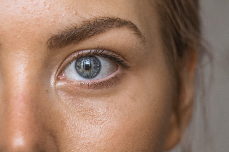 What should I avoid after blepharoplasty surgery