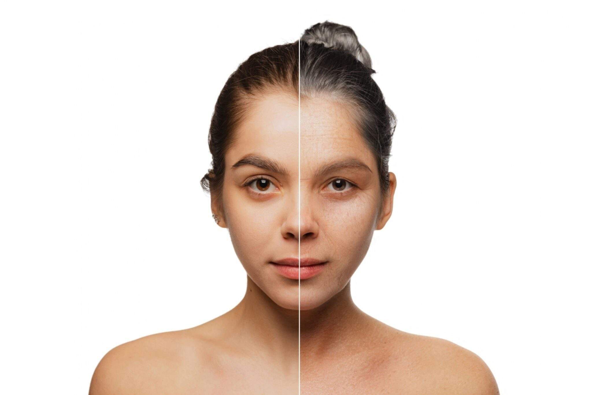 Anti Aging Treatment in Bangalore for Age Spots and Hyperpigmentation 1 Anti Aging Treatment in Bangalore for Age Spots and Hyperpigmentation
