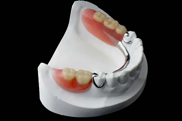 Partial Teeth Dentures: A Comprehensive Guide
