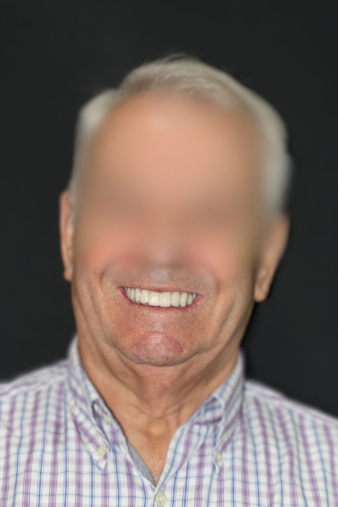 Implantes dentales en hospitalet de llobregat 2 371mKbMKzDRPr7z7sHfr84QLux9Hc3ejryBoyifYeuqQcENqXvLQEQACB3EHU2Tq