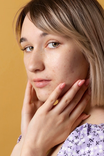 The Latest Innovations in Acne Laser Treatments 1 The Latest Innovations in Acne Laser Treatments