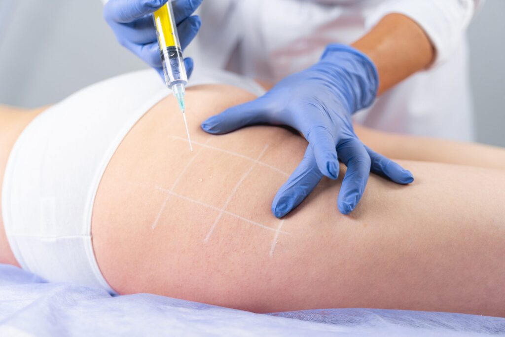 Fat Melting Injections: A Revolutionary Solution for Dubai’s Fitness Enthusiasts 1 Fat Melting Injections in Dubai