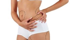 Liposuction Surgery in Dubai: Transform Your Physique Precision 1 Liposuction Surgery in Dubai: Transform Your Physique Precision