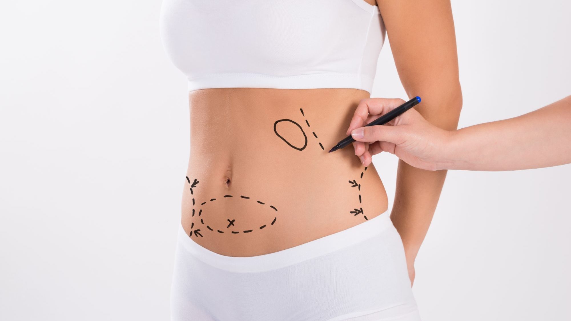 2024 Liposuction Surgery Guide for Dubai 1 2024 Liposuction Surgery Guide for Dubai
