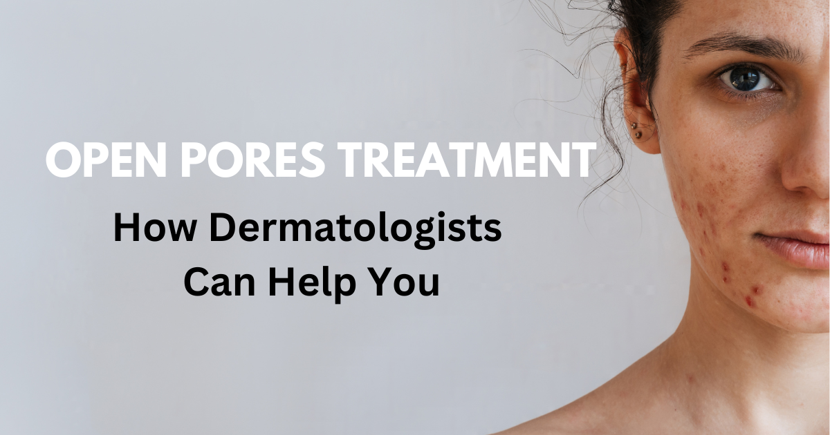 Open Pores Treatment: How Dermatologists Can Help You Achieve Smoother Skin