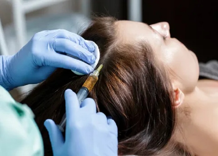 PRP Hair Treatment in Riyadh: Revitalizing Hair Growth Naturally