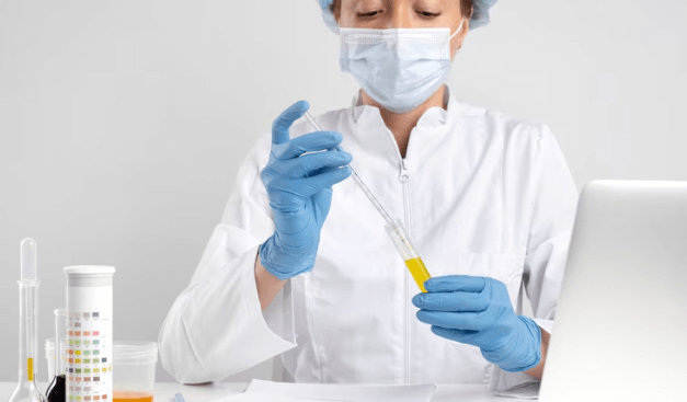 How to Prepare for a Uric Acid Test: A Complete Guide 1 How to Prepare for a Uric Acid Test: A Complete Guide