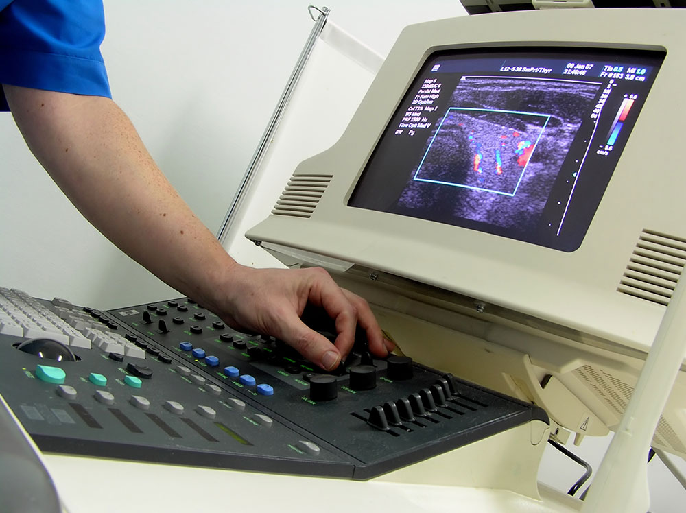 what is transvaginal ultrasounds, Procedure, and Benefits 1 what is transvaginal ultrasounds, Procedure, and Benefits