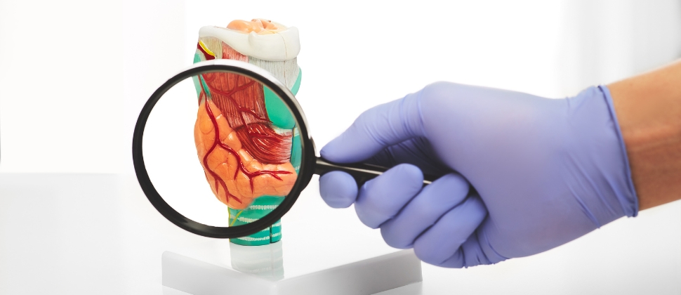 What Causes Thyroid Goiter and How to Prevent It From Worsening 1 What Causes Thyroid Goiter and How to Prevent It From Worsening