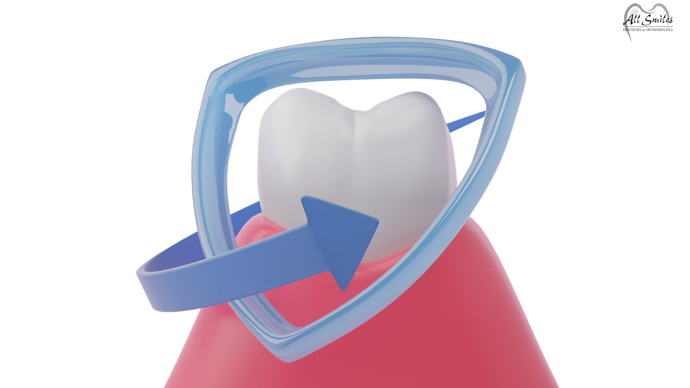 Healthy Gums: Top Causes of Bleeding Gums & Tips for Proper Oral Care 1 Healthy Gums: Top Causes of Bleeding Gums & Tips for Proper Oral Care