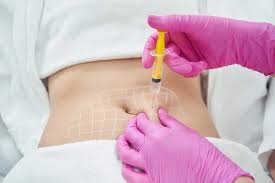 Feel Confident Again with Lipolysis Injections in Dubai 1 Feel Confident Again with Lipolysis Injections in Dubai