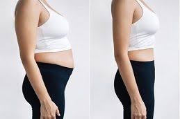 Mounjaro injection in Dubai FAQs Answered by Experts 1 Mounjaro injection in Dubai FAQs Answered by Experts
