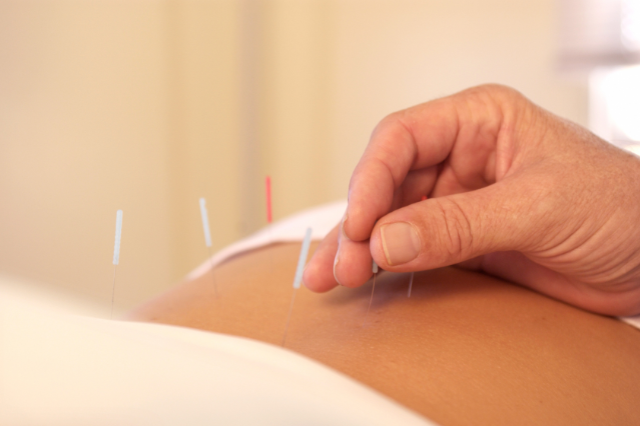 Boosting Immunity Naturally: How Acupuncture Supports Your Body’s Defenses 1 Boosting Immunity Naturally: How Acupuncture Supports Your Body’s Defenses