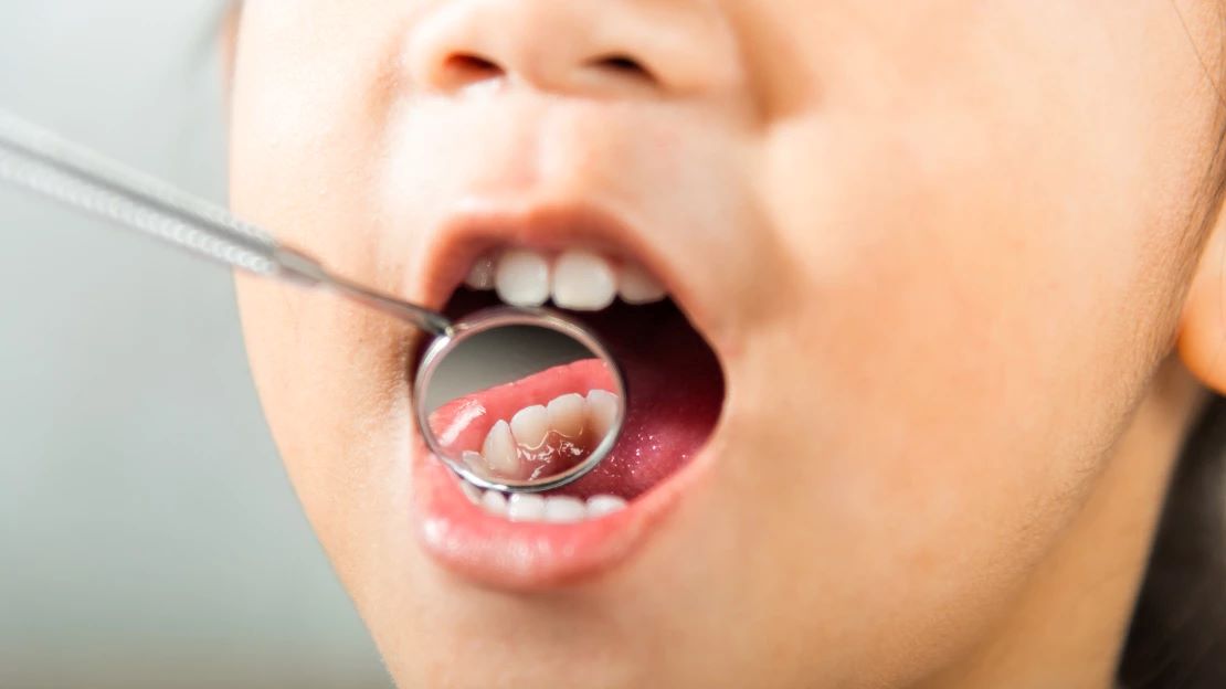 Why Early Orthodontic Treatment in Nampa ID is Key to Your Child's Healthy Smile 1 Why Early Orthodontic Treatment in Nampa ID is Key to Your Child’s Healthy Smile