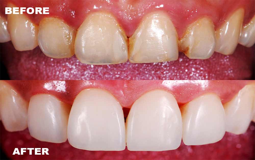 Transform Your Smile with Expert Cosmetic Dentistry in Portland OR for a Brighter Look