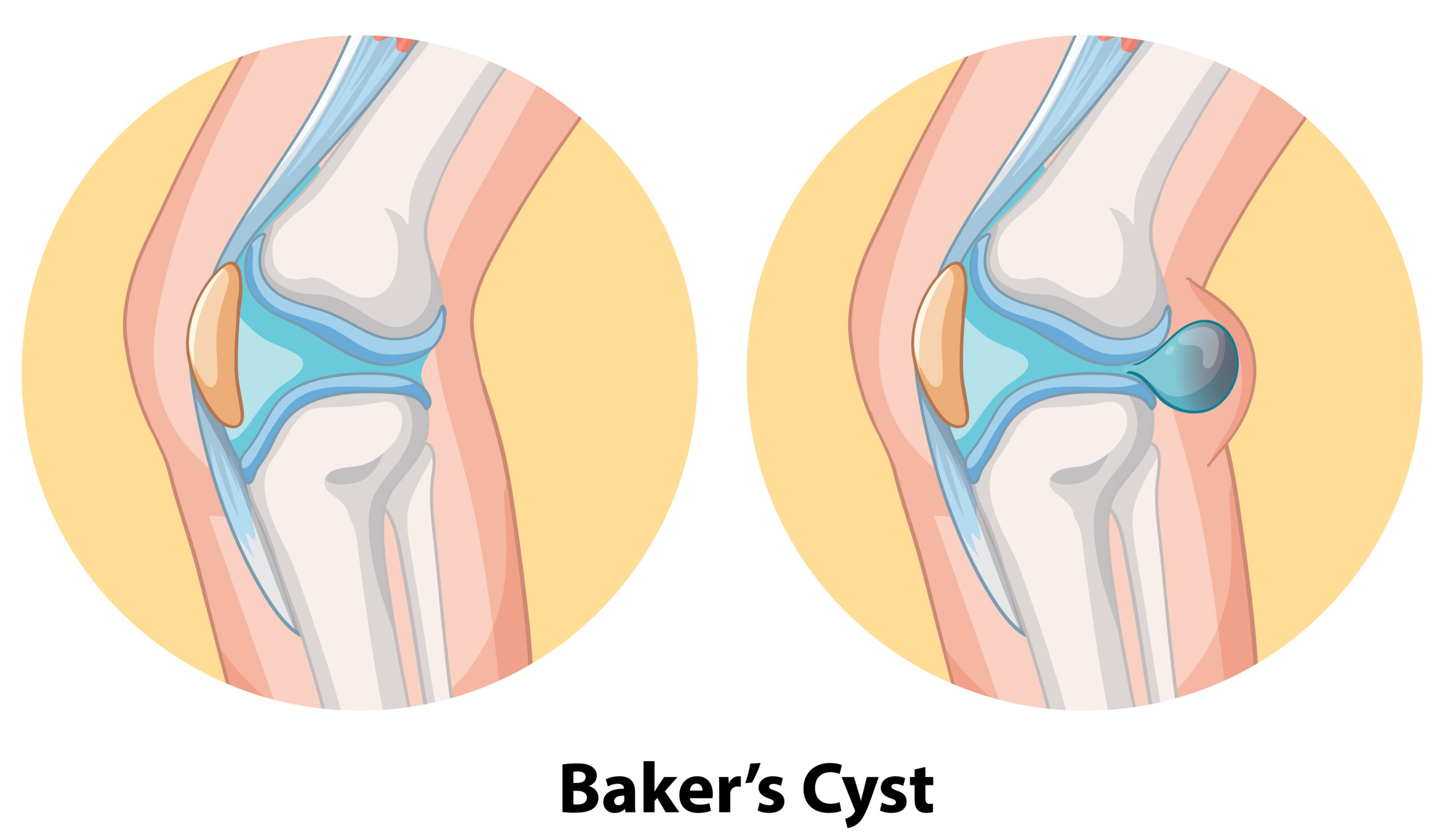 How much does knee replacement surgery cost 1 How much does knee replacement surgery cost