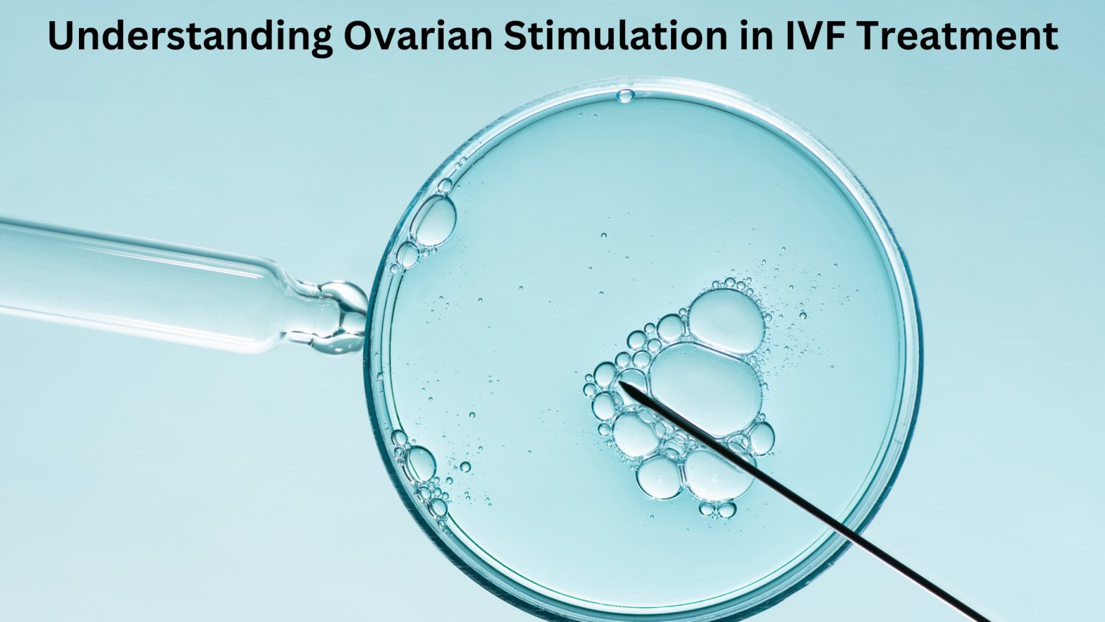 Understanding Ovarian Stimulation in IVF Treatment 1 Understanding Ovarian Stimulation in IVF Treatment