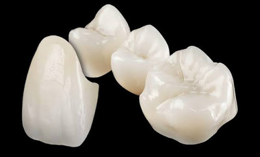 Understanding the Cost of Zirconia Crowns: Are They Worth It? 1 Understanding the Cost of Zirconia Crowns: Are They Worth It?