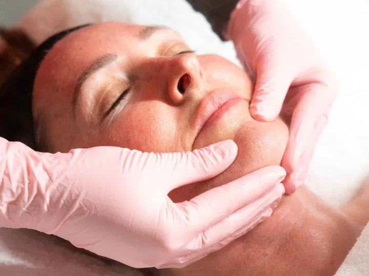 Say Goodbye to Smokers Lines: Top Treatments That Really Work