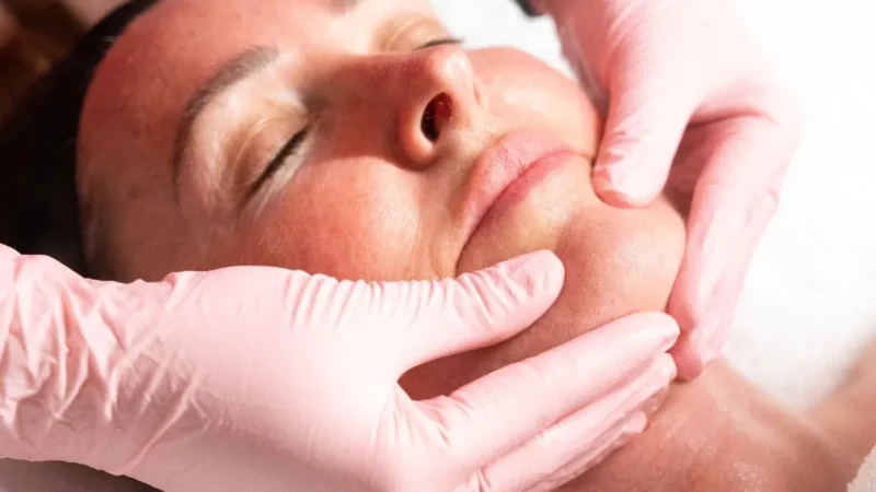 Say Goodbye to Smokers Lines: Top Treatments That Really Work