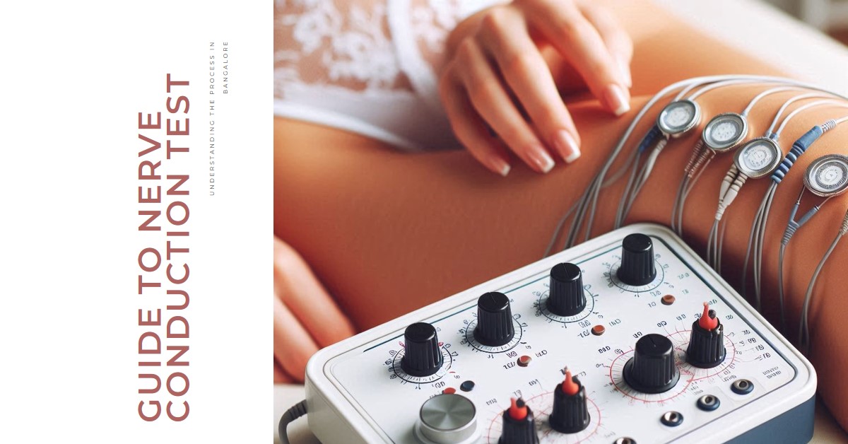 Nerve Conduction Velocity Test in Bangalore: Comprehensive Guide 1 Nerve Conduction Velocity Test in Bangalore: Comprehensive Guide
