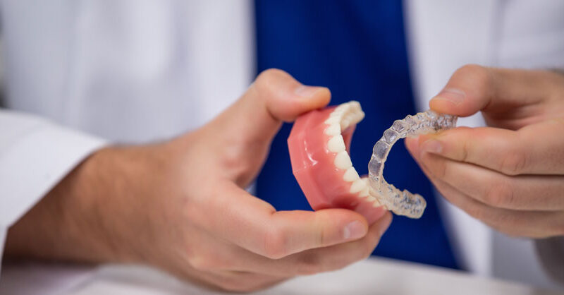 What Are the Advantages of Same Day Dental Veneers from a Cosmetic Dentist in North Miami Beach?
