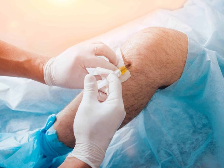 What Are the Most Effective Knee Pain Treatments in New York?