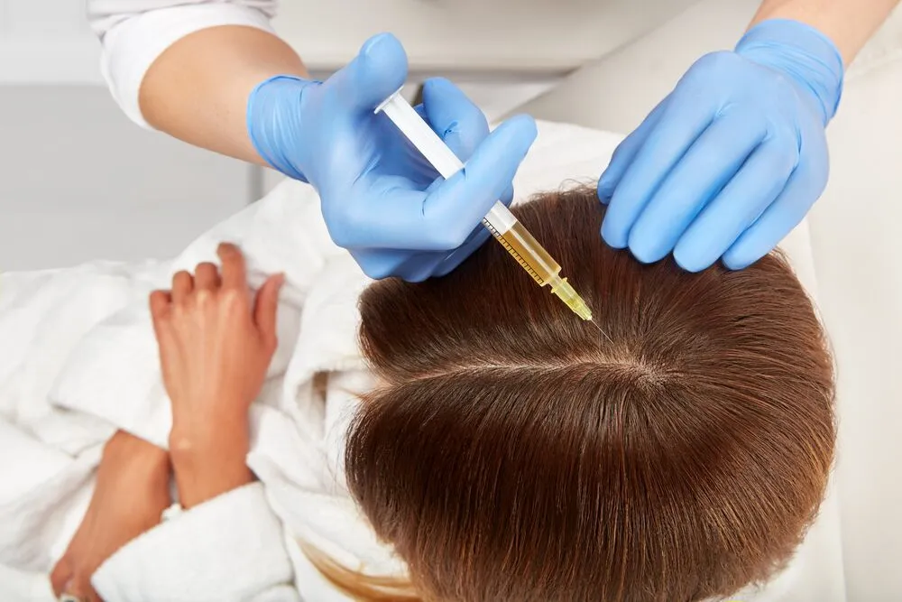 Hair Plasma Therapy: Boost Your Hair's Health Naturally 1 Hair Plasma Therapy: Boost Your Hair’s Health Naturally