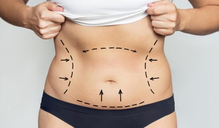 Does Lipotropic Injections Increase Your Fat Burning Potential?