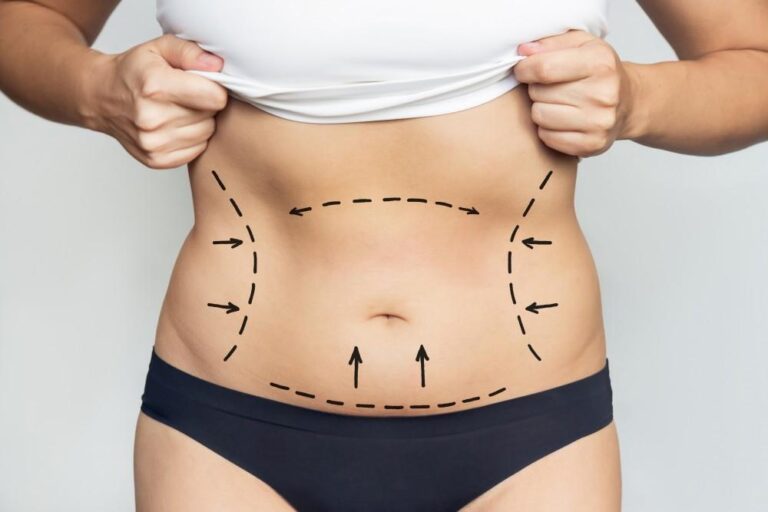 Does Lipotropic Injections Increase Your Fat Burning Potential? 1 Does Lipotropic Injections Increase Your Fat Burning Potential?