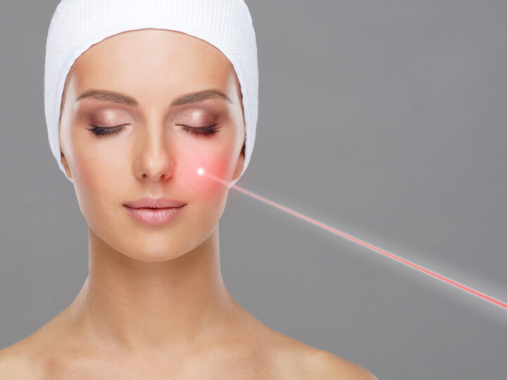 How to Prepare Your Skin for Laser Treatment in Lucknow?
