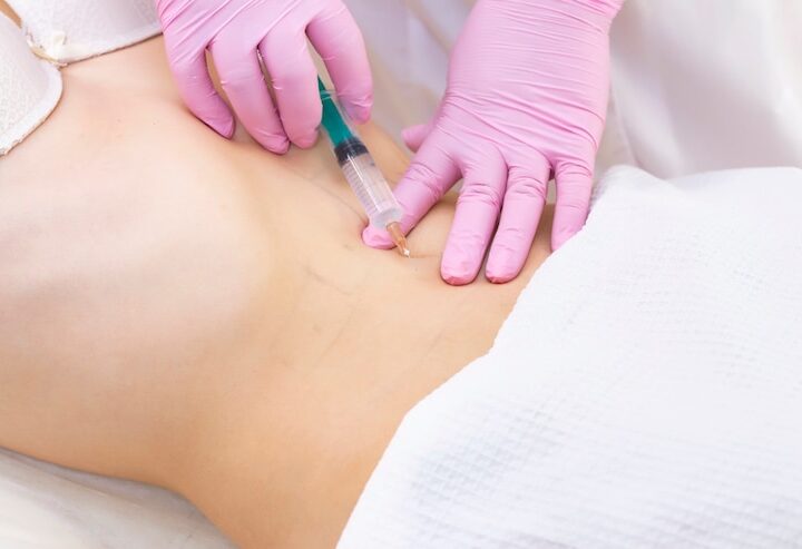 How Does Body Filler Treatment Change Your Figure?