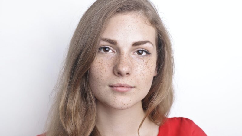 Does Freckles and Blemishes Treatment Work on All Skin Types?