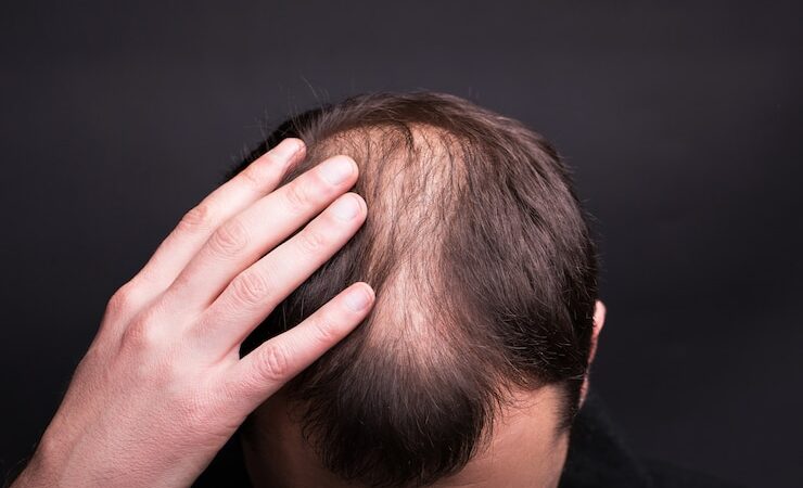 Is Hair Transplant Pain Management Really Effective?