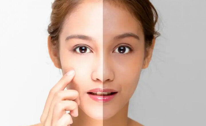 Best Skin Brightening for Tanned Skin Whitening in Dubai