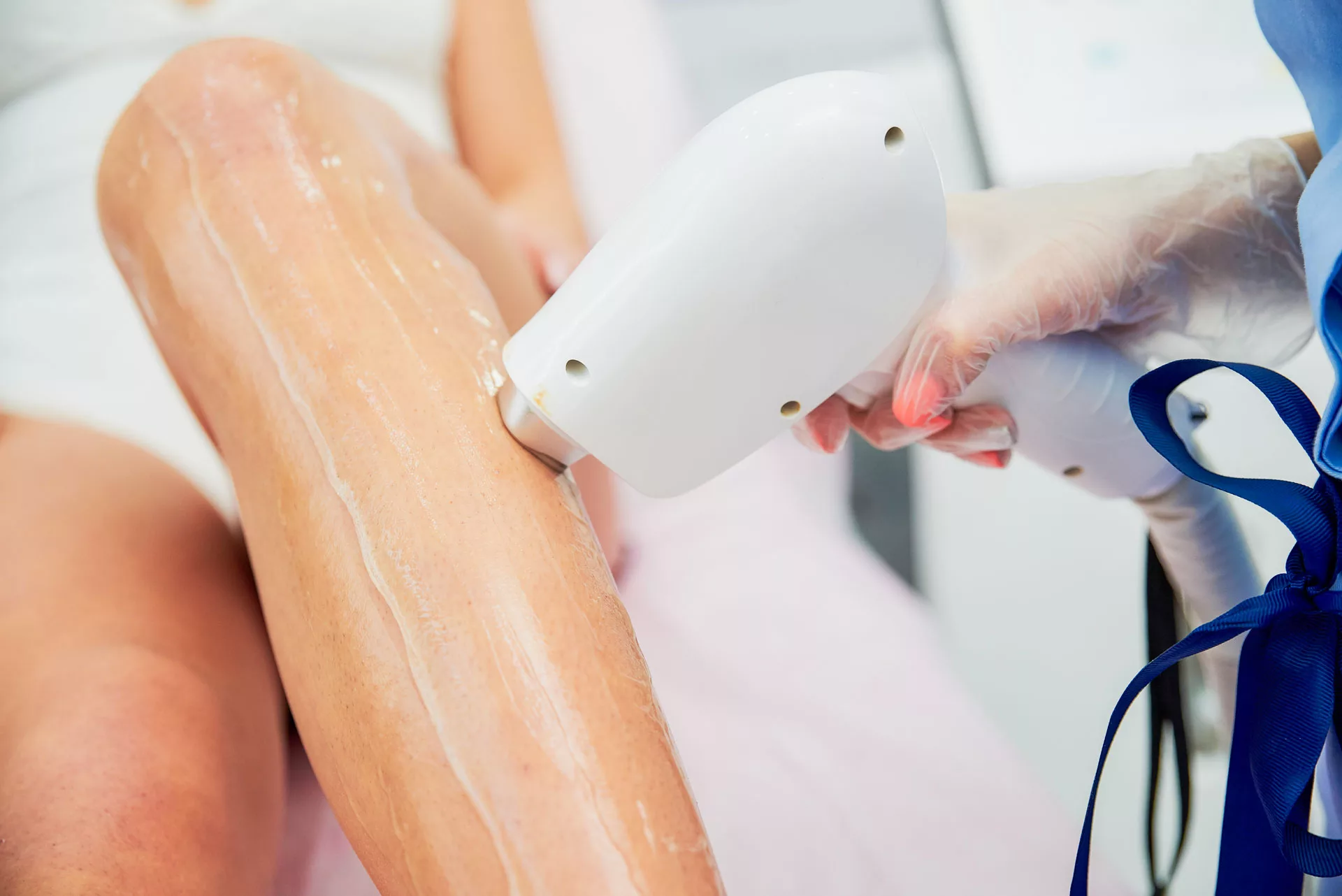 How Much for Laser Hair Removal on Leg Area? 1 How Much for Laser Hair Removal on Leg Area?