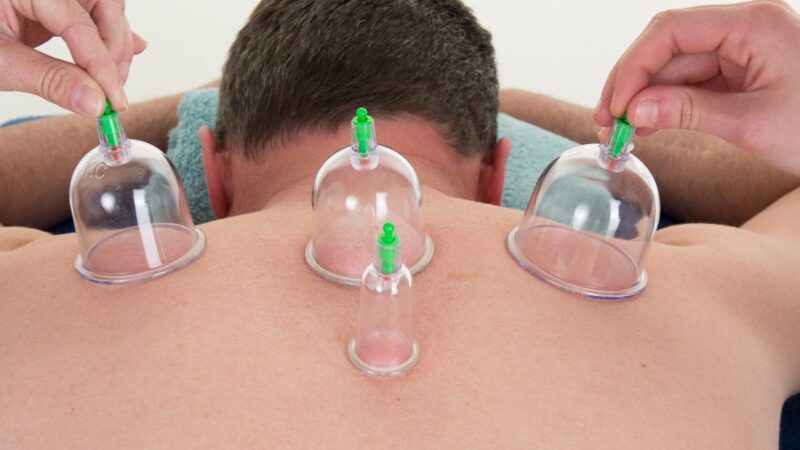 What Are Spiritual Benefits Of Hijama Wet Cupping?