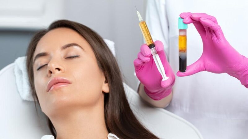 Does PRP Hair Treatment Help Stress-Related Hair Loss?