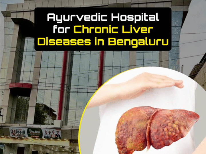 Top Ayurvedic Hospital for Chronic Liver Diseases in Koramangala, Bengaluru