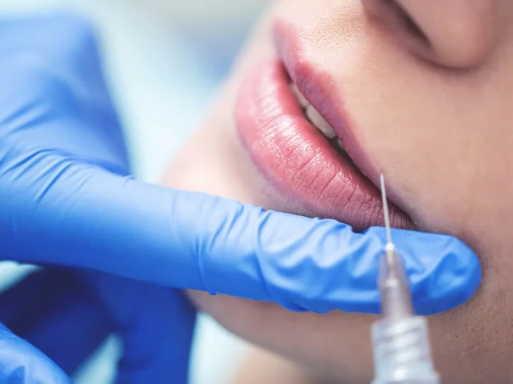 Where Can You Get Botox Treatment in Springfield?