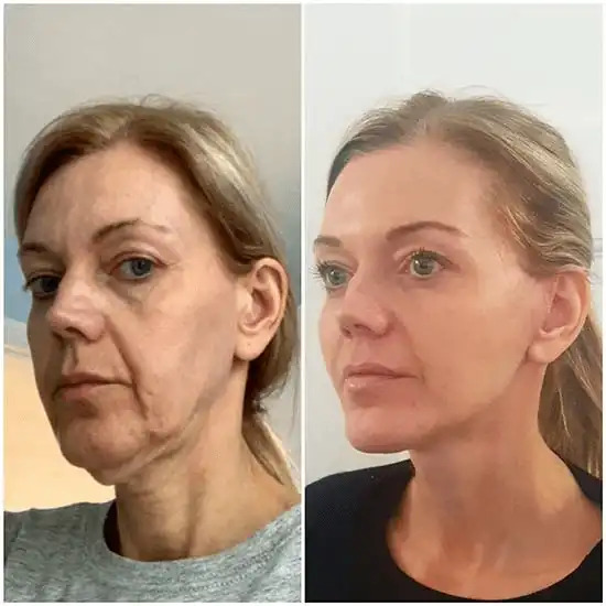 Natural or Voluptuous? What the Best Breast Augmentation Surgeons in Dubai Recommend 1 Natural or Voluptuous? What the Best Breast Augmentation Surgeons in Dubai Recommend