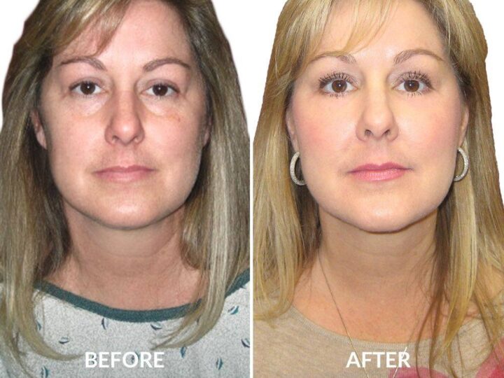 Why Choose Cosmetic Surgery in Houston for Your Aesthetic Goals?