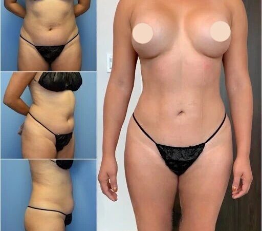 Best Body Contouring Surgeons in dubai: Success Stories and Transformations