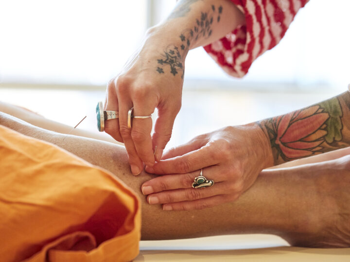 Natural Relief with Acupuncture for Health Philadelphia