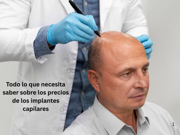 Todo lo que necesita saber sobre los precios de los implantes capilares