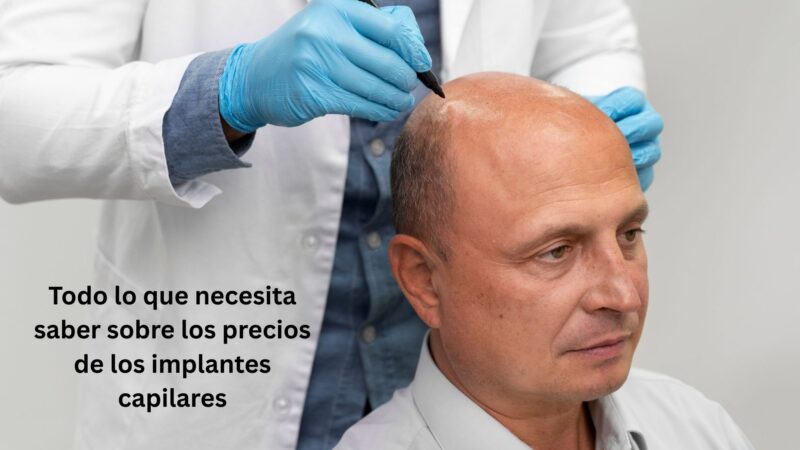 Todo lo que necesita saber sobre los precios de los implantes capilares