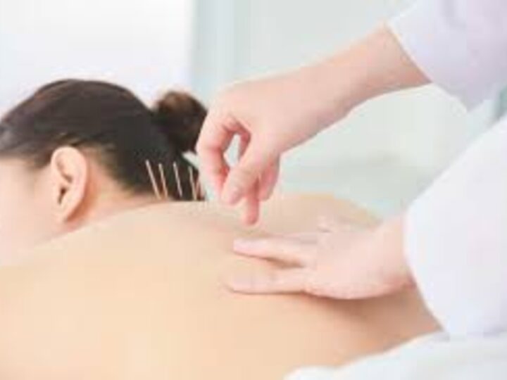 How a Nearby Medical Billing Company Can Streamline Insurance Claims for Acupuncture Clinics