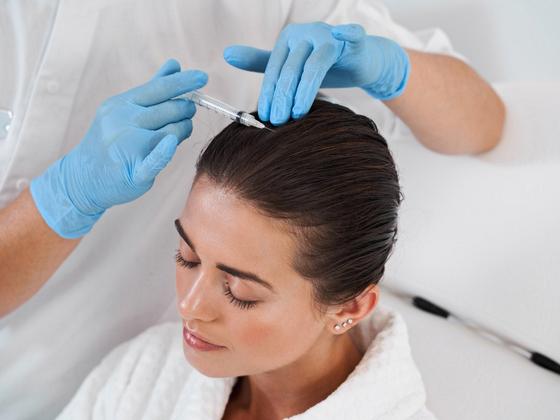 Does PRP Hair Treatment Help Stress-Related Hair Loss?
