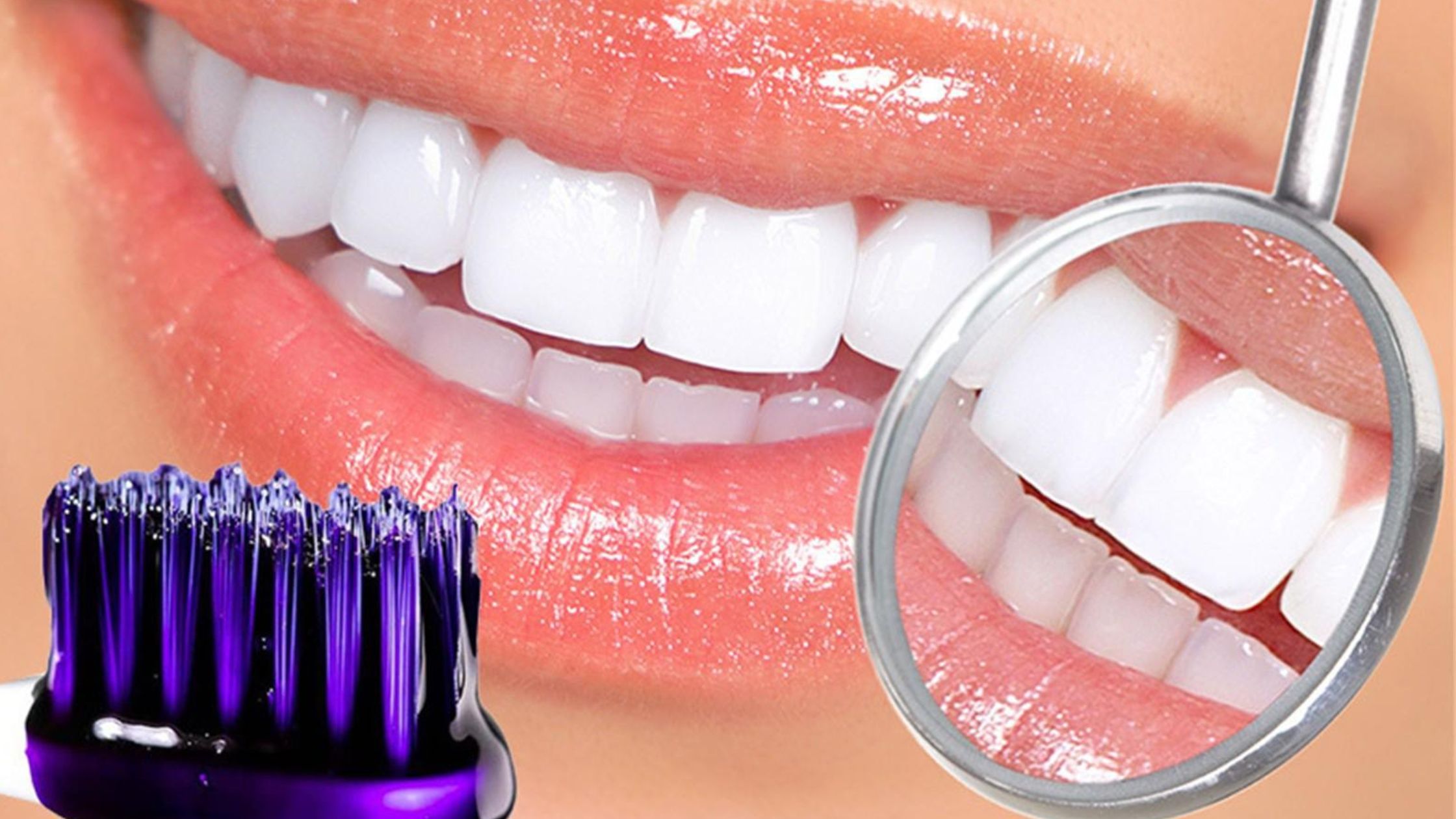 Does MySmile Purple Toothpaste Work on All Tooth Shades? 1 Does MySmile Purple Toothpaste Work on All Tooth Shades?