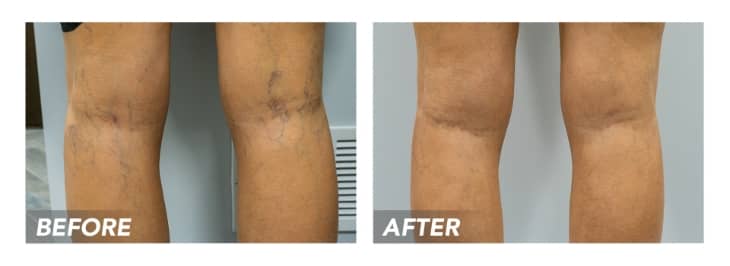 Are Your Symptoms Telling You to Visit a Vascular Specialist?